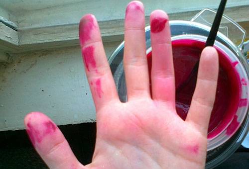 Fucorcin stains on hand