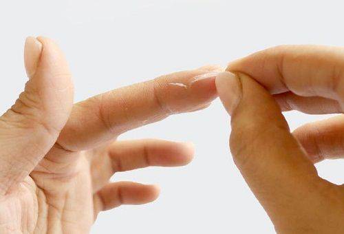 super moment glue on the hands
