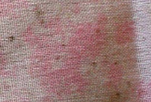 mold on fabric