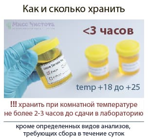 Cik daudz urīna jāuzglabā, lai veiktu ticamu analīzi