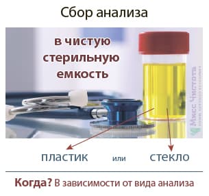 Urīna analīžu kolekcija