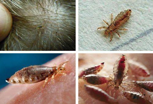 lice lice