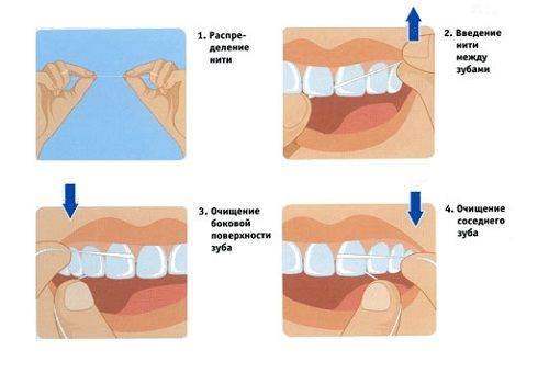 flossing sequence