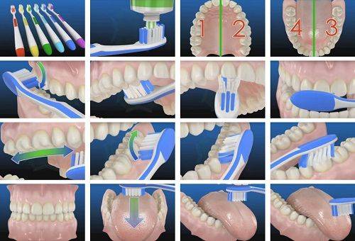brushing sequence