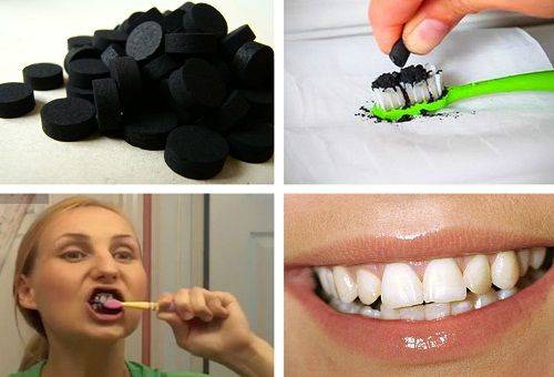 teeth whitening