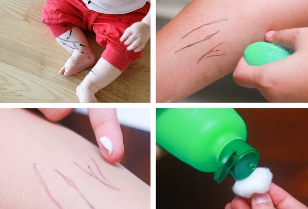 stain remover