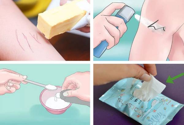 stain remover