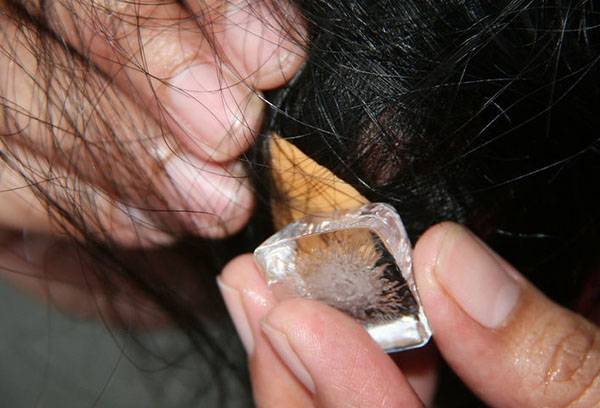 Freezing chewing gum in hair