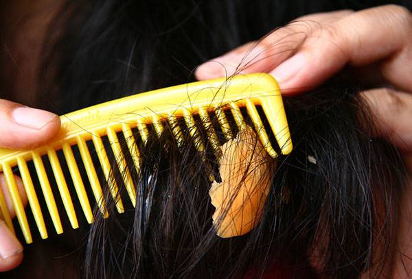 Combing chewing gum from hair