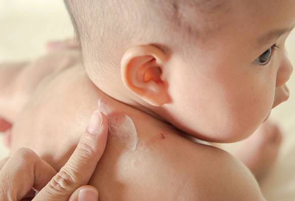 Allergic reaction in a child