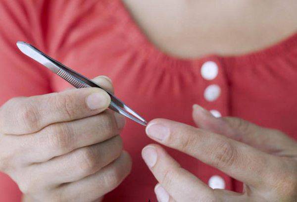 Extraction of tweezers by tweezers