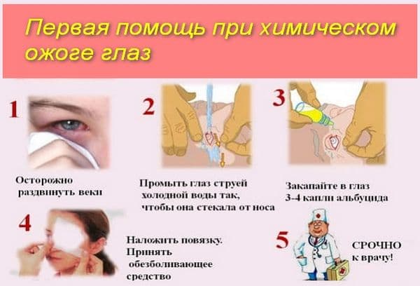 Palīdzība ar ķīmisku apdegumu