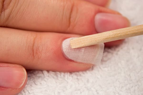 Restoration of a broken nail